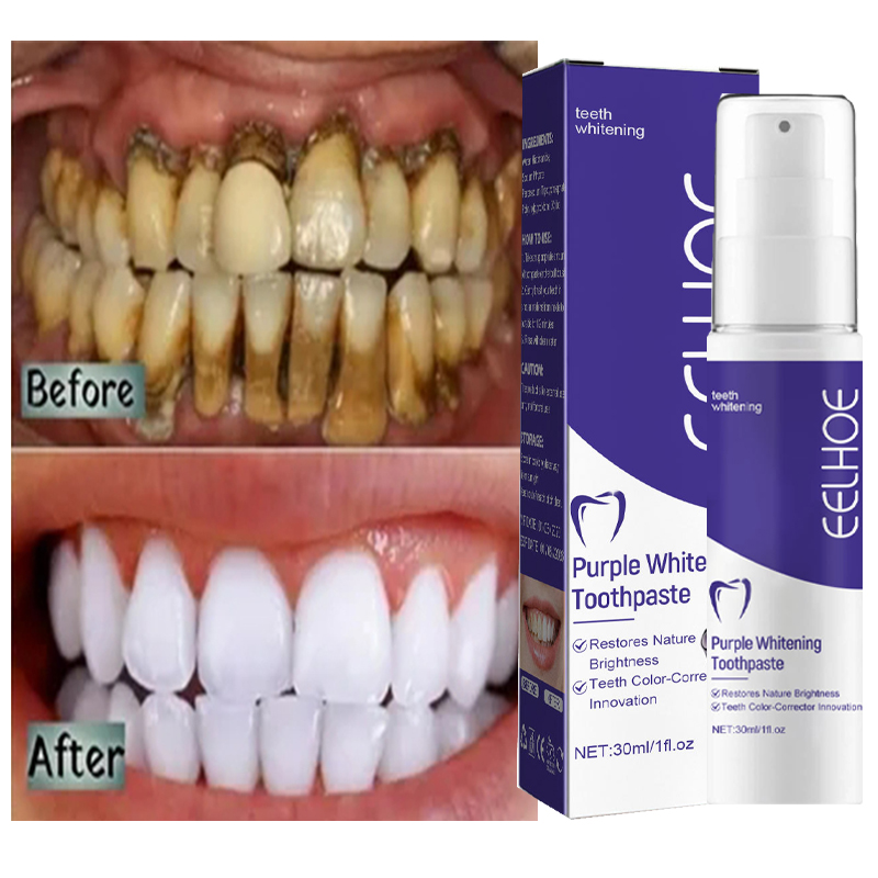 Teeth Whitening Korea - Pasta de dientes piezas limpieza dental,