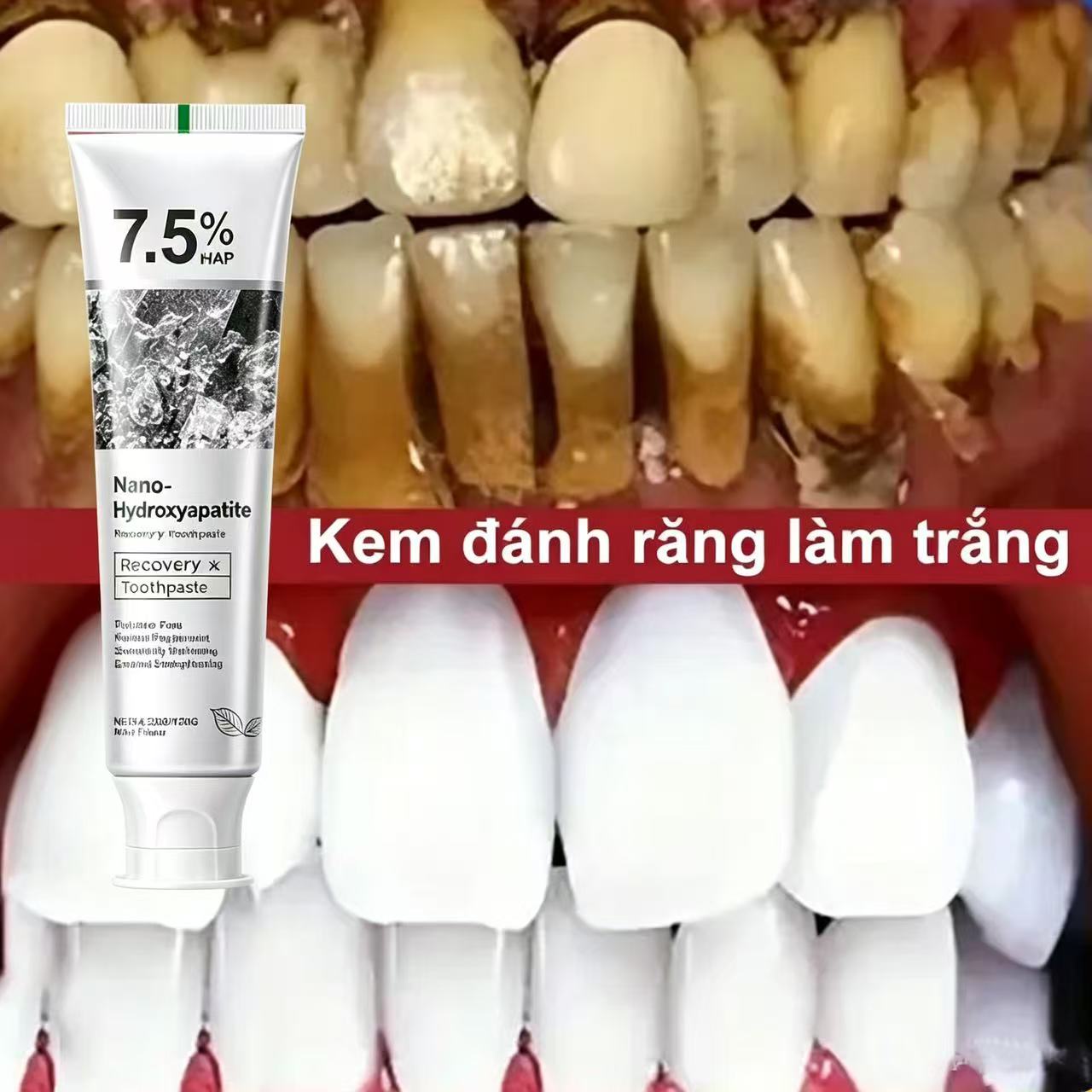 Teeth Whitening Treatment - Pasta Dental Blanqueadora Probiótica con 7.5%