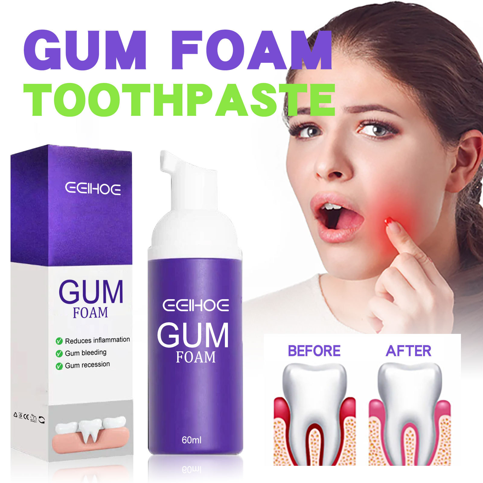 Teeth Whitening Best - Mousse blanqueador de dientes V34, 60ml,