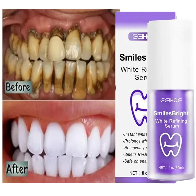 Teeth Whitening Korea - Limpieza de dientes, pasta de dientes
