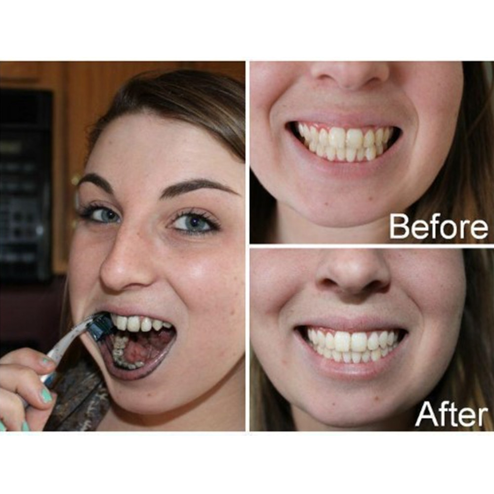 Dientes de carbón de bambú par - Teeth Whitening App reseña y precio