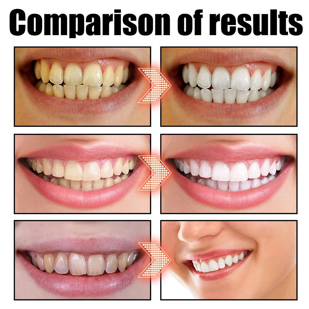 Enjuague Bucal de Coco y Menta - Teeth Whitening With Coconut Oil reseña y precio