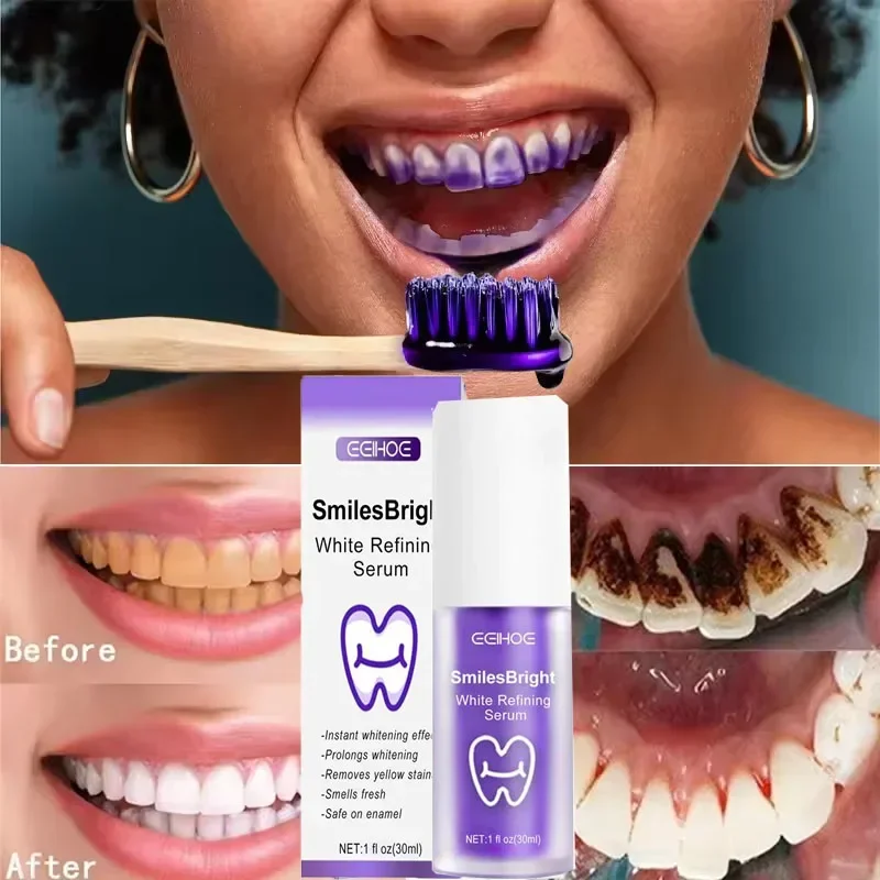 Limpieza de dientes, pasta de  - Teeth Whitening Korea reseña y precio