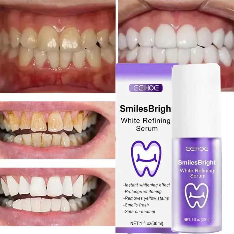 Limpieza de dientes, pasta de  - Teeth Whitening Korea reseña y precio