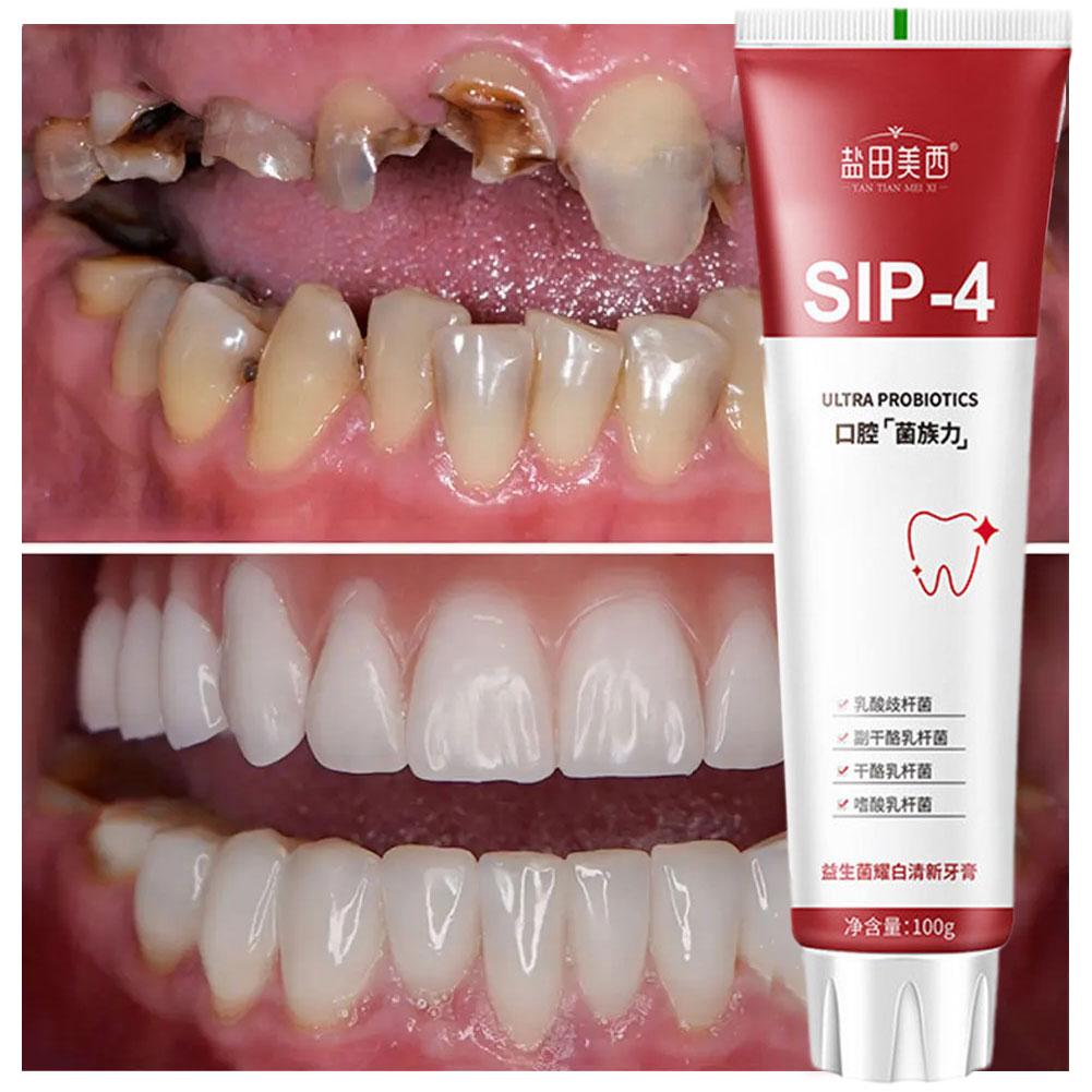 Pasta Dental Blanqueadora Prob - Teeth Whitening Treatment reseña y precio