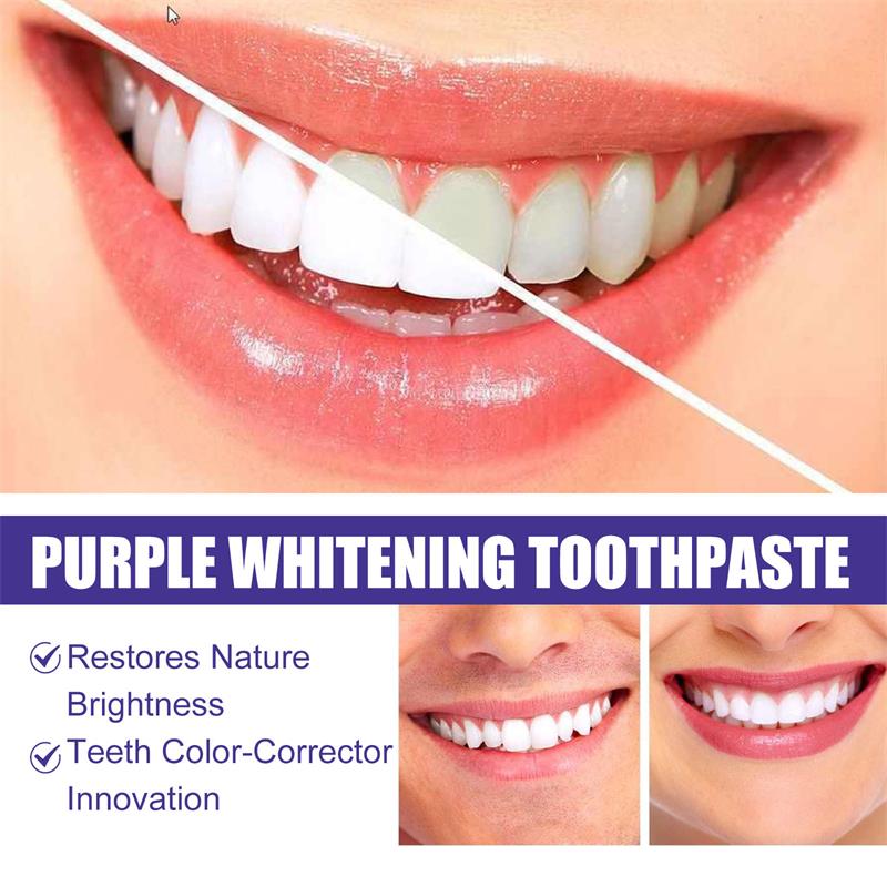 Pasta Dental Blanqueadora, Gel - Teeth Whitening Korea reseña y precio