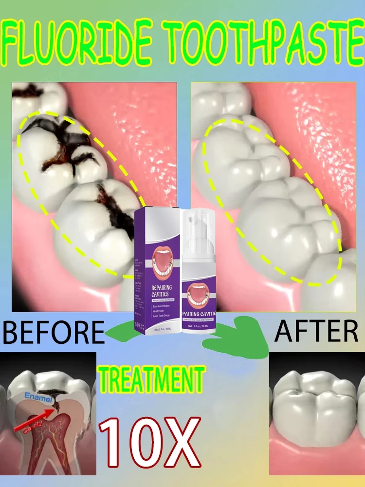 Ventas calientes Más vendido,  - Teeth Whitening Best reseña y precio