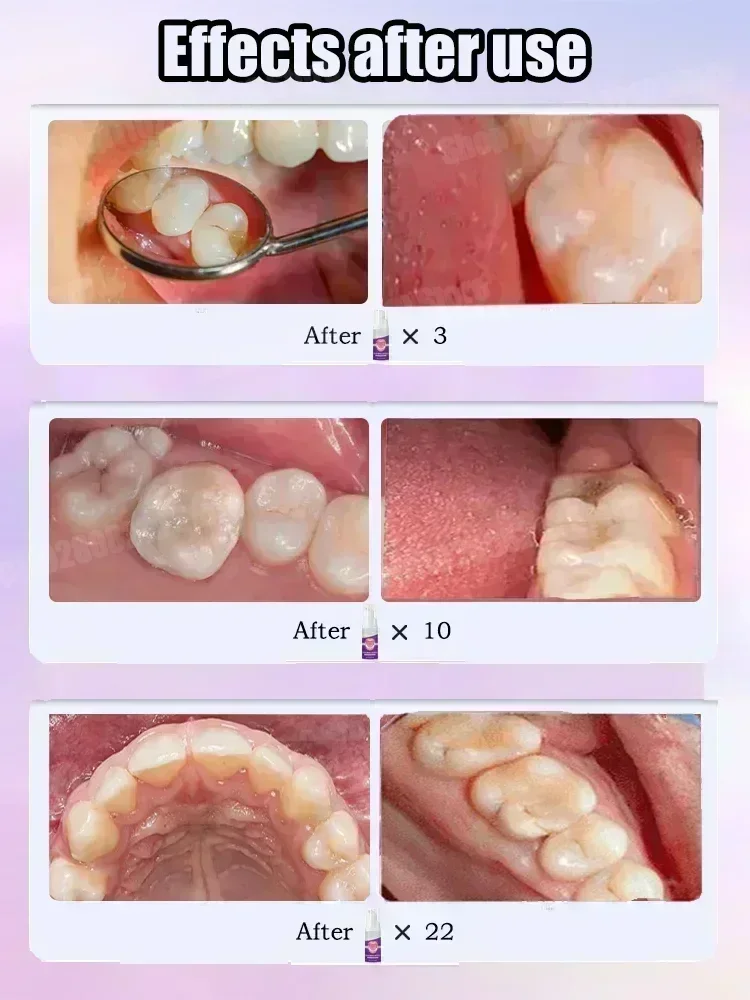 Ventas calientes Más vendido,  - Teeth Whitening Best reseña y precio