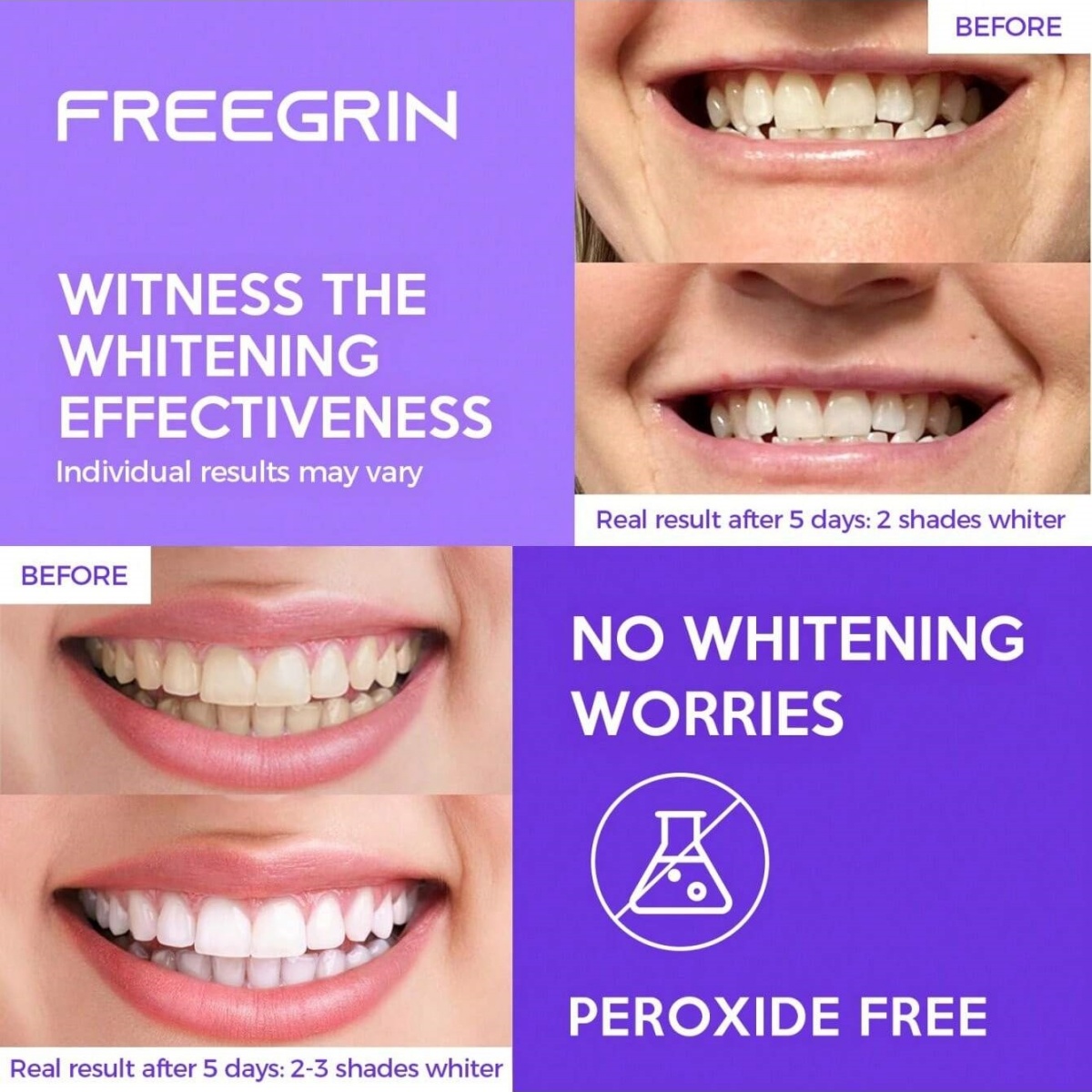 Pegatinas blanqueadoras de die - Teeth Whitening With Hydrogen Peroxide reseña y precio