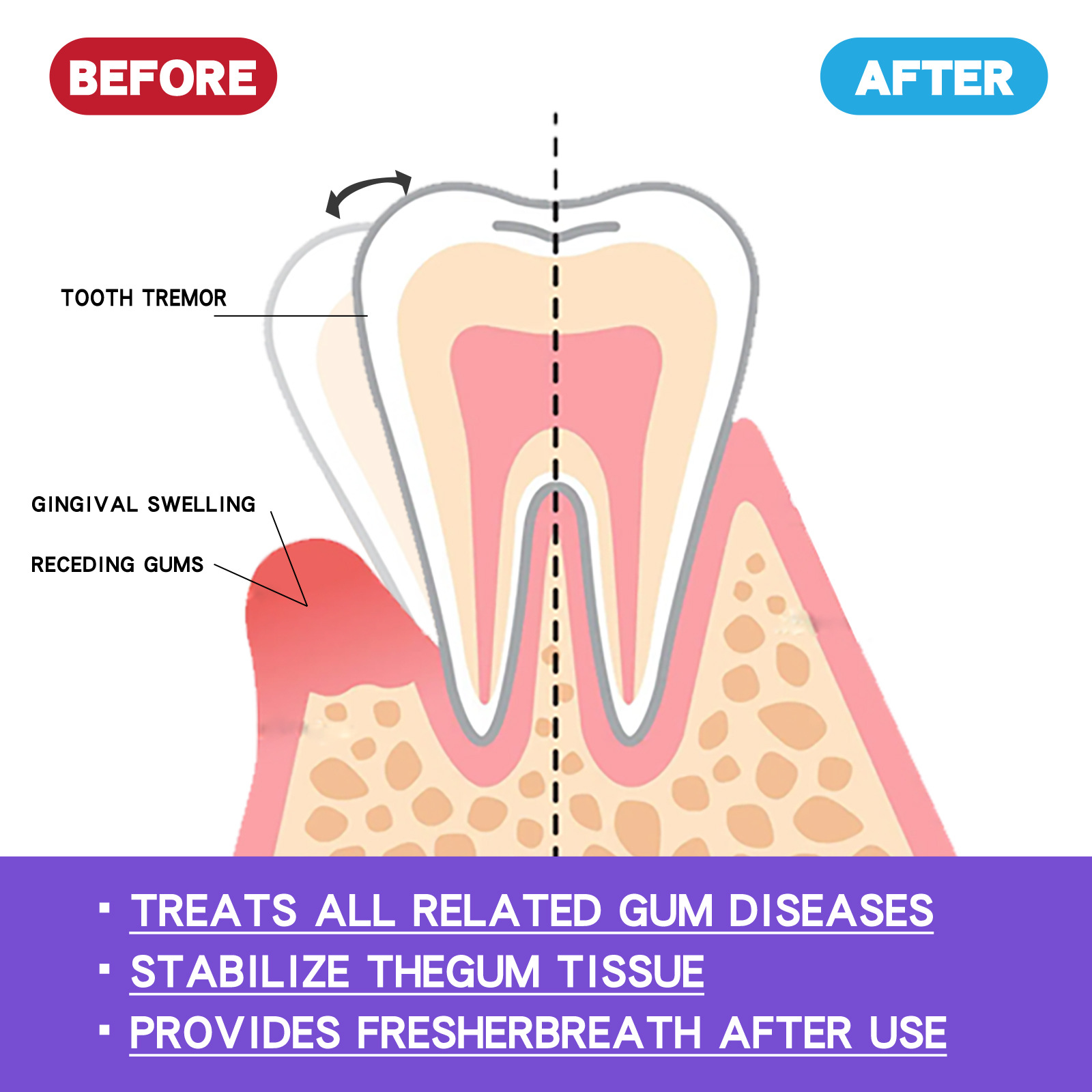 Mousse blanqueador de dientes  - Teeth Whitening Best reseña y precio