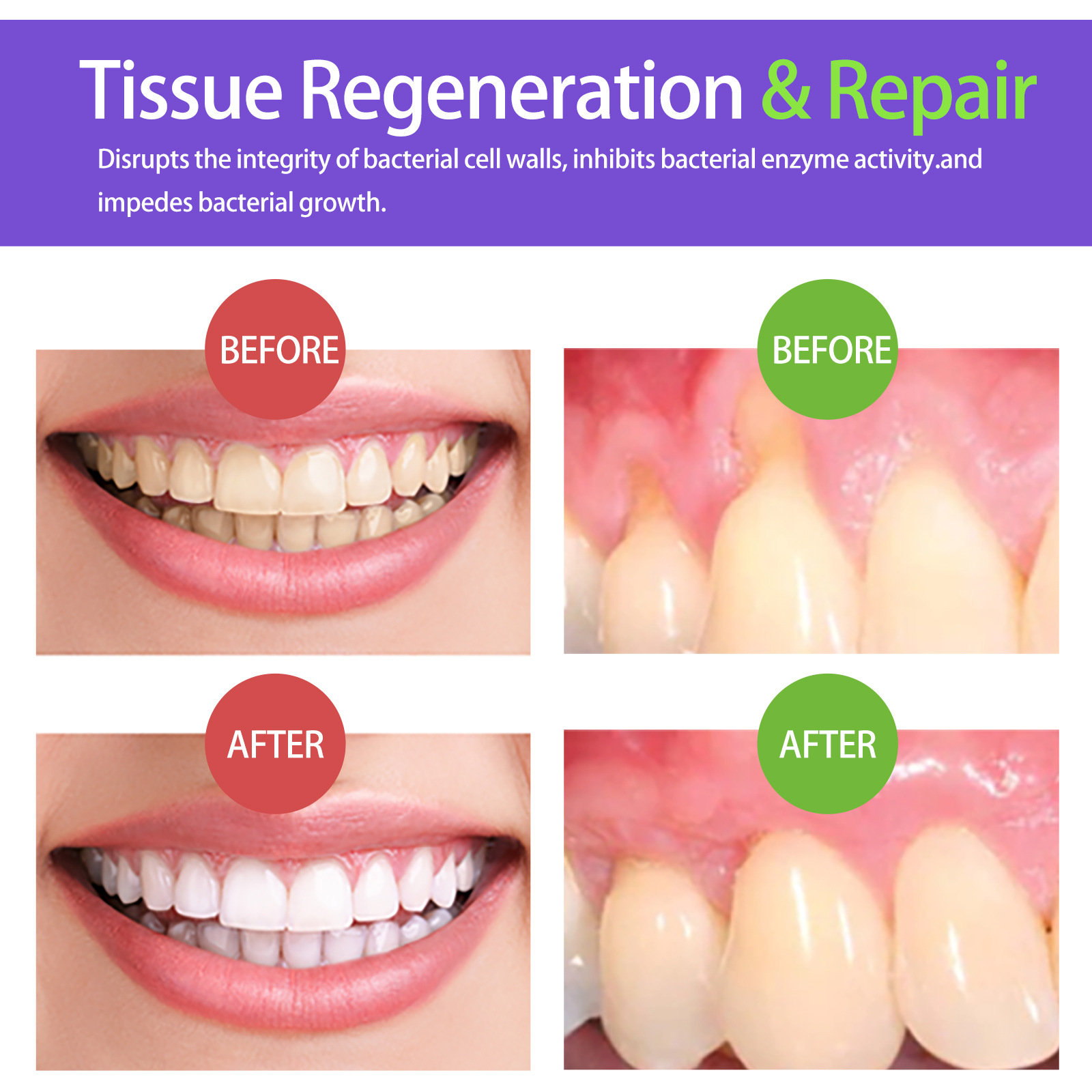 Mousse blanqueador de dientes  - Teeth Whitening Best reseña y precio