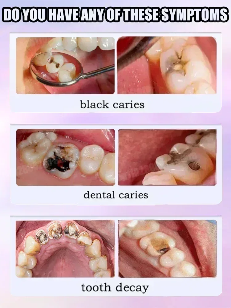 Pasta de dientes para limpieza - Teeth Whitening Treatment reseña y precio